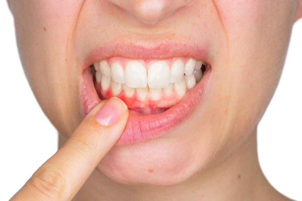 Tụt lợi gây hậu quả gì?