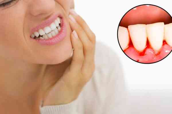 Chảy máu chân răng: Nguyên nhân và cách khắc phục