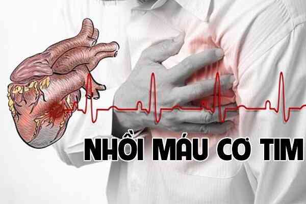 Nhận biết nhồi máu cơ tim