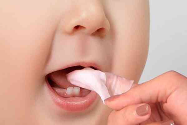 Cách xử trí bệnh nấm lưỡi ở trẻ nhỏ